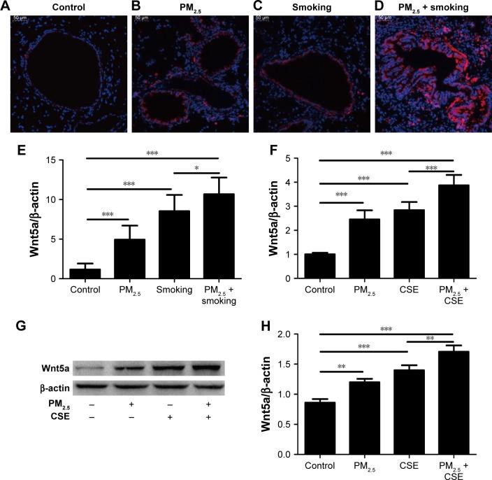 https://cdn.ncbi.nlm.nih.gov/pmc/blobs/c951/6512785/d8f80a4b96b3/copd-14-979Fig4.jpg