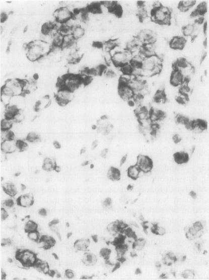 https://cdn.ncbi.nlm.nih.gov/pmc/blobs/c957/498609/22adeb98e213/jclinpath00172-0021-a.jpg