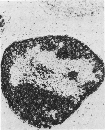 https://cdn.ncbi.nlm.nih.gov/pmc/blobs/c957/498609/8a0317251cf1/jclinpath00172-0022-a.jpg