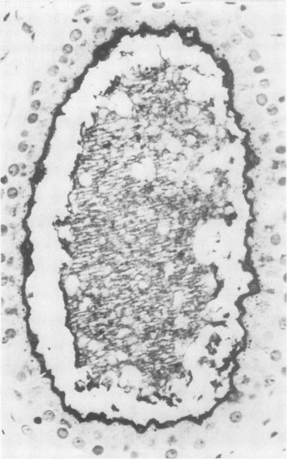 https://cdn.ncbi.nlm.nih.gov/pmc/blobs/c957/498609/9524f00213d9/jclinpath00172-0021-b.jpg