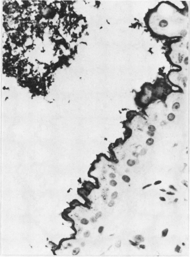 https://cdn.ncbi.nlm.nih.gov/pmc/blobs/c957/498609/b2f0cf6b198b/jclinpath00172-0020-a.jpg