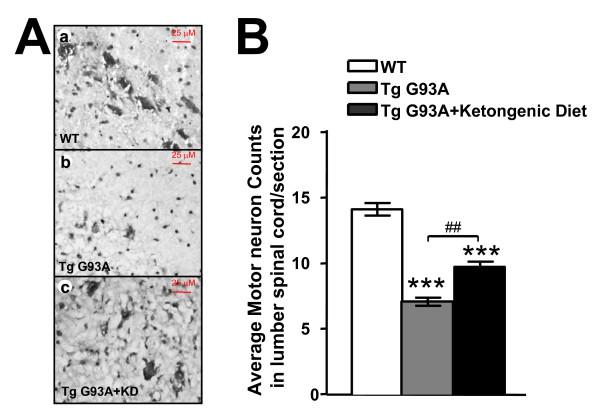 https://cdn.ncbi.nlm.nih.gov/pmc/blobs/c96a/1488864/4572be693dca/1471-2202-7-29-2.jpg