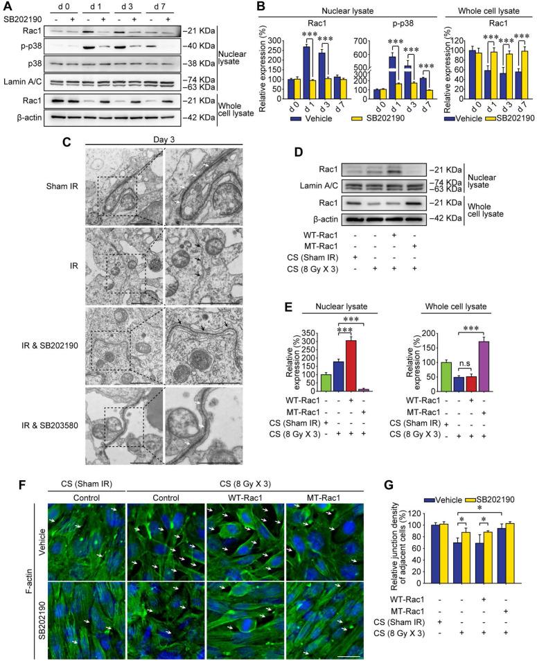 https://cdn.ncbi.nlm.nih.gov/pmc/blobs/c96a/8058717/d22dca5cec1b/thnov11p5742g004.jpg