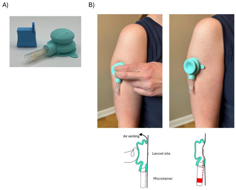 https://cdn.ncbi.nlm.nih.gov/pmc/blobs/c97f/12345872/59108063b6ab/diagnostics-15-01935-g001.jpg