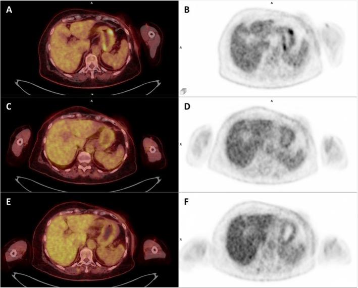 https://cdn.ncbi.nlm.nih.gov/pmc/blobs/c980/12420364/eda3d3091c3b/CCR3-13-e70881-g001.jpg