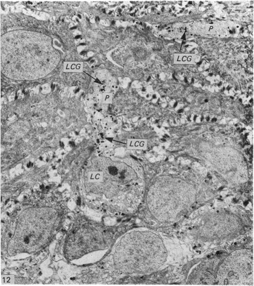 https://cdn.ncbi.nlm.nih.gov/pmc/blobs/c981/1233219/dbc0105da62f/janat00232-0088-b.jpg