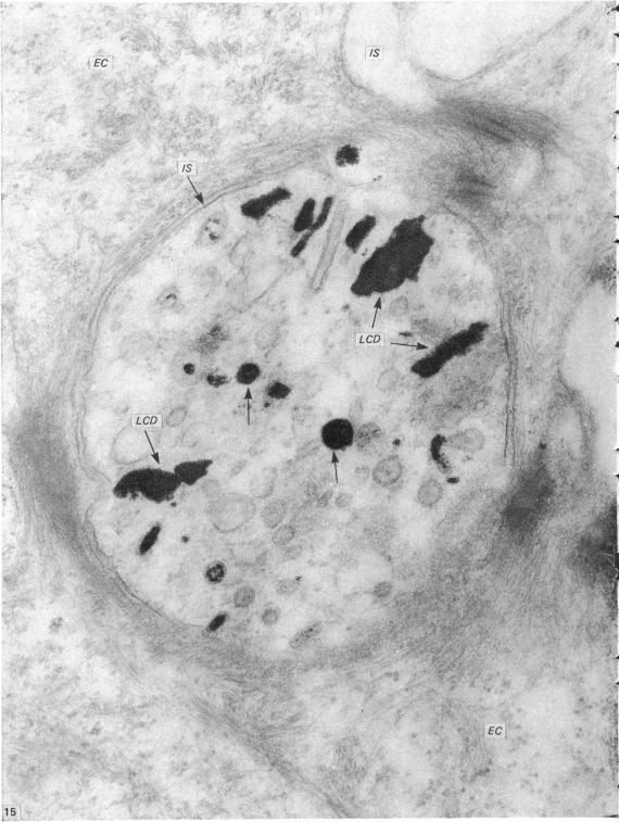 https://cdn.ncbi.nlm.nih.gov/pmc/blobs/c981/1233219/f0d93d474c95/janat00232-0091-a.jpg