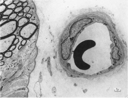 https://cdn.ncbi.nlm.nih.gov/pmc/blobs/c981/1365486/5db1adfa854b/jphysiol01121-0037-a.jpg