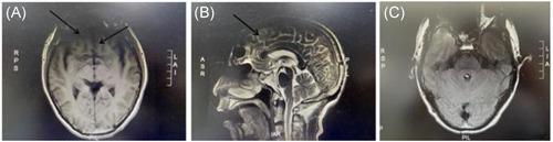 https://cdn.ncbi.nlm.nih.gov/pmc/blobs/c98b/10528969/02e890bfab5e/IBRA-8-15-g002.jpg