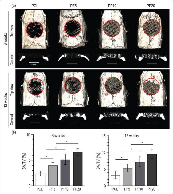 https://cdn.ncbi.nlm.nih.gov/pmc/blobs/c98b/9947485/1deb3f76e04d/IJB-9-1-636-g005.jpg