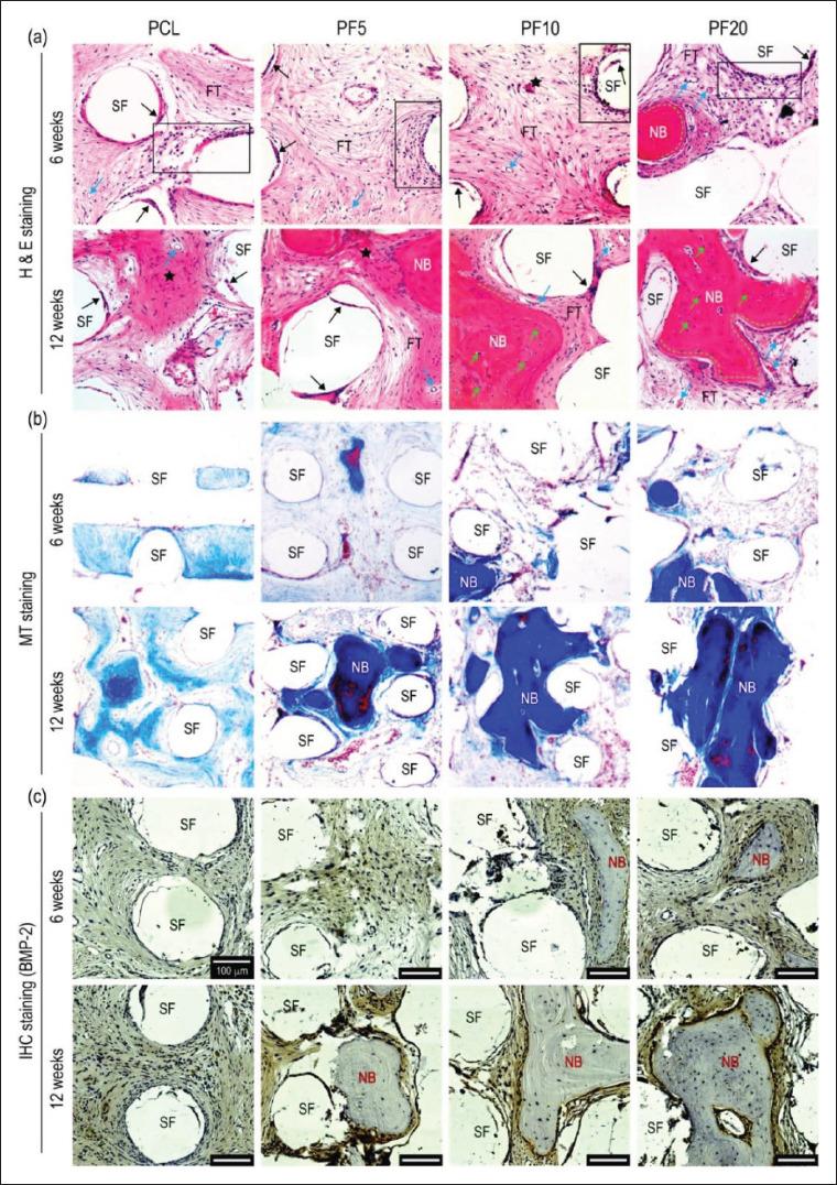 https://cdn.ncbi.nlm.nih.gov/pmc/blobs/c98b/9947485/898f8bcc9e5c/IJB-9-1-636-g006.jpg