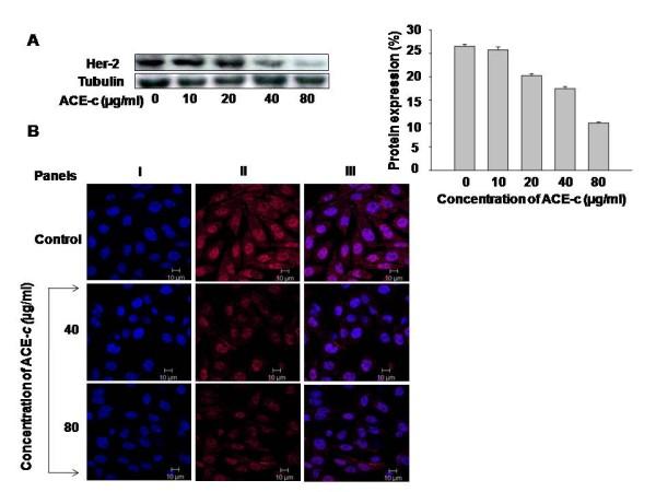 https://cdn.ncbi.nlm.nih.gov/pmc/blobs/c991/2893107/050cabb31f18/1471-2407-10-210-3.jpg