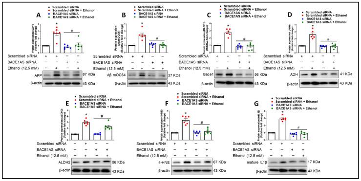 https://cdn.ncbi.nlm.nih.gov/pmc/blobs/c993/11274690/8ab63faaf636/cells-13-01173-g006.jpg