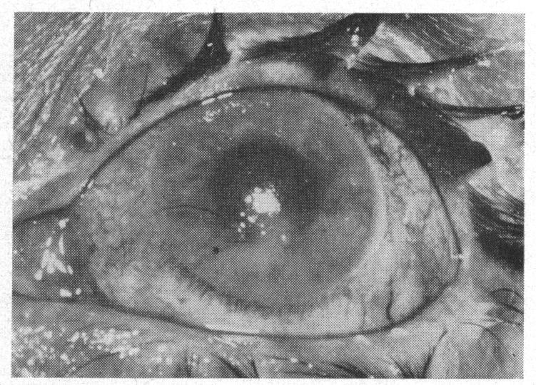 https://cdn.ncbi.nlm.nih.gov/pmc/blobs/c999/510194/34f0eb101291/brjopthal00413-0026-b.jpg