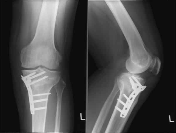 https://cdn.ncbi.nlm.nih.gov/pmc/blobs/c9a4/2789041/9f7a14781f74/1758-2555-1-26-4.jpg