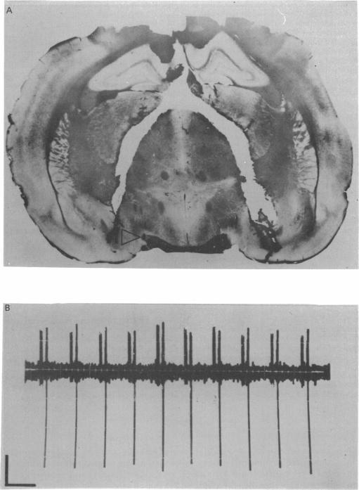 https://cdn.ncbi.nlm.nih.gov/pmc/blobs/c9a7/1275421/44cb1e0588e8/jphysiol00708-0442-a.jpg