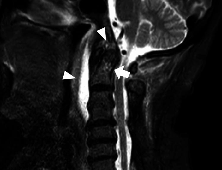 https://cdn.ncbi.nlm.nih.gov/pmc/blobs/c9a9/10854273/da8e936d18b4/cureus-0016-00000052012-i02.jpg