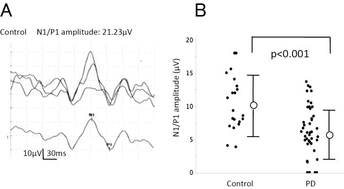 https://cdn.ncbi.nlm.nih.gov/pmc/blobs/c9ad/5140858/90c29a72f367/1349-7235-55-3113-g001.jpg
