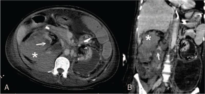 https://cdn.ncbi.nlm.nih.gov/pmc/blobs/c9af/8568413/a3ee19925bd0/medi-100-e27549-g003.jpg