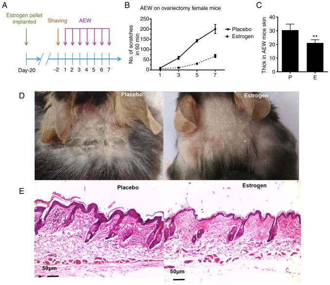 https://cdn.ncbi.nlm.nih.gov/pmc/blobs/c9b8/10155243/ff2fdd162b29/etm-25-06-11954-g01.jpg