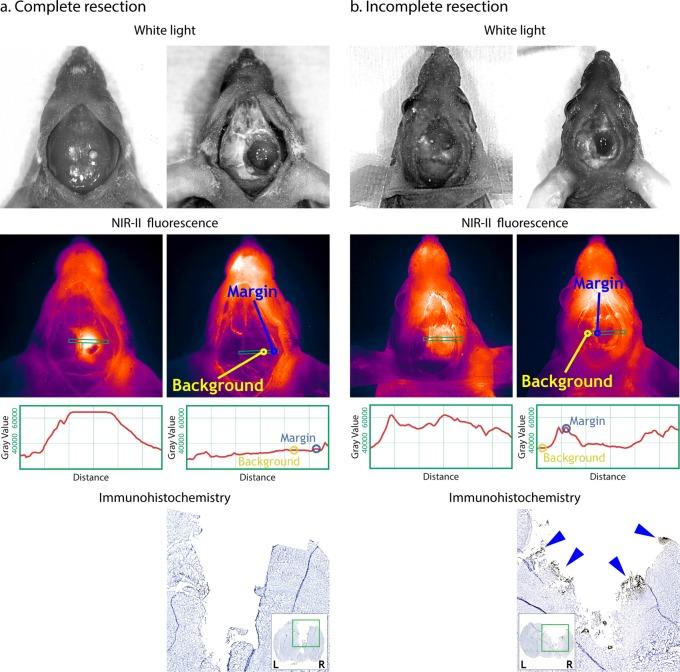 https://cdn.ncbi.nlm.nih.gov/pmc/blobs/c9c9/6363276/8fb3fc56a18e/bc-2018-006697_0003.jpg