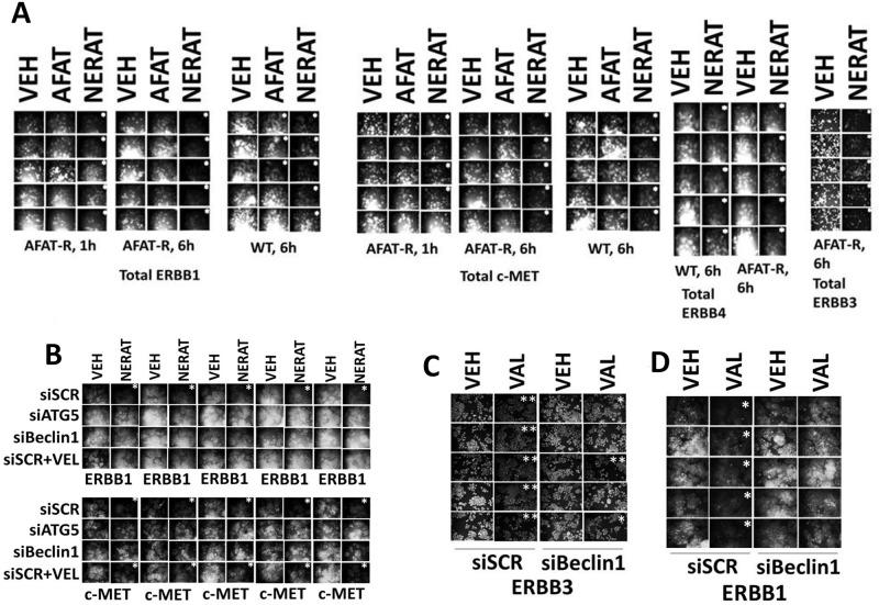 https://cdn.ncbi.nlm.nih.gov/pmc/blobs/c9ce/5685747/17df15f3a38e/oncotarget-08-90262-g004.jpg