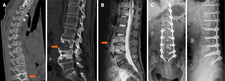https://cdn.ncbi.nlm.nih.gov/pmc/blobs/c9dd/12278289/aa8784e5671d/wjo-16-7-106041-g003.jpg