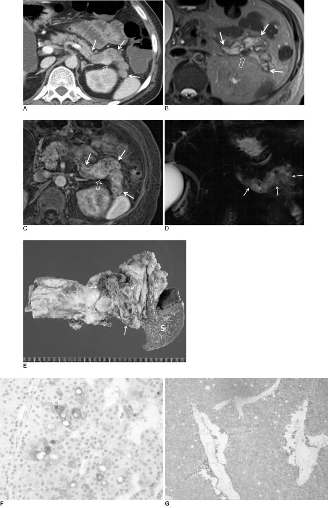 https://cdn.ncbi.nlm.nih.gov/pmc/blobs/c9de/2864868/c8ea8250fefa/kjr-11-378-g001.jpg