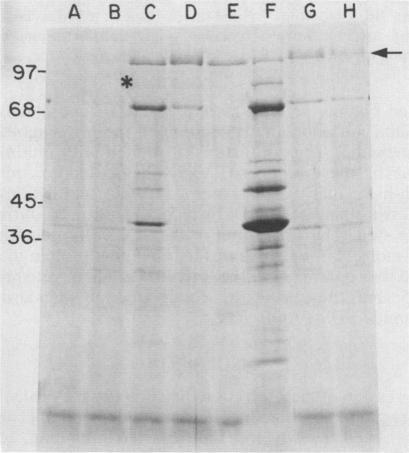 https://cdn.ncbi.nlm.nih.gov/pmc/blobs/c9e8/259775/0039a9230c2d/iai00077-0149-b.jpg
