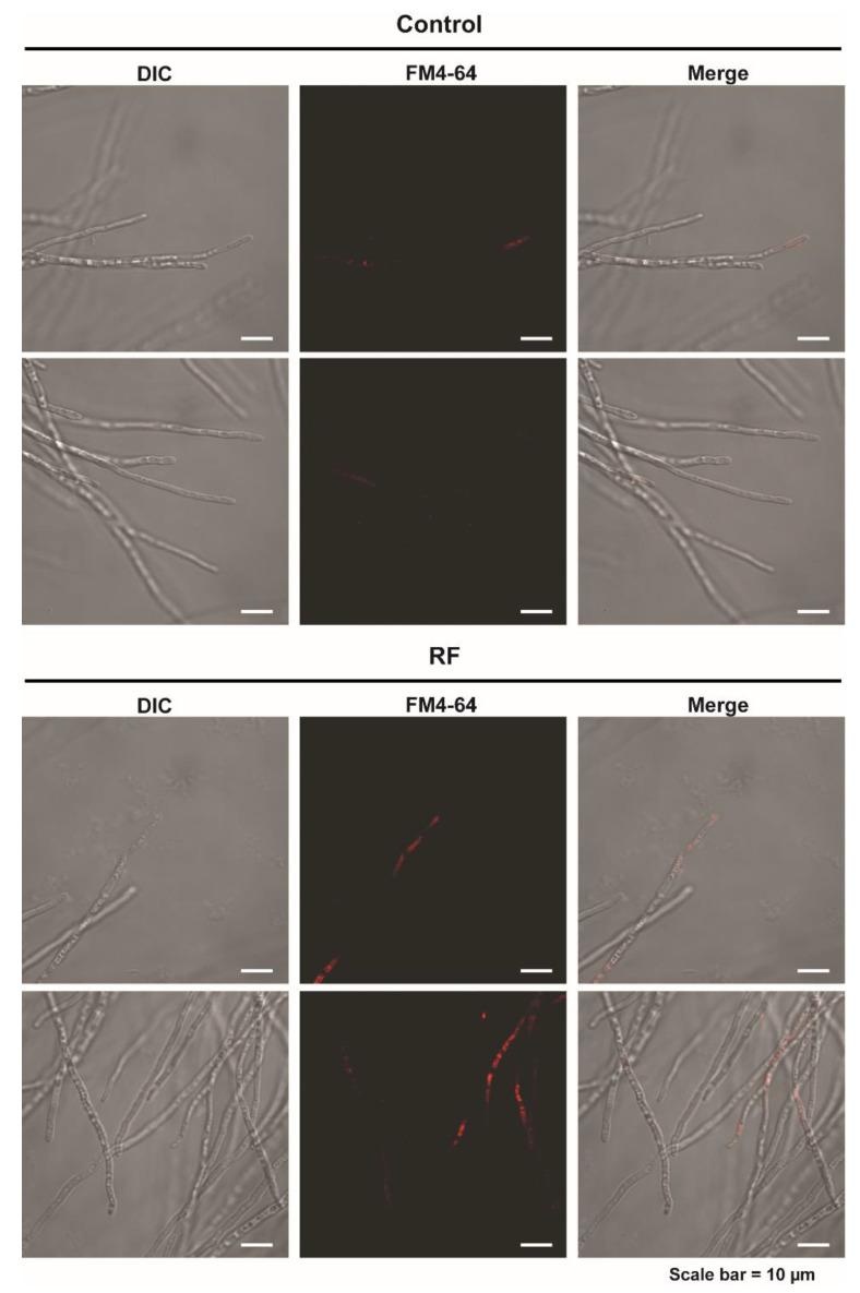 https://cdn.ncbi.nlm.nih.gov/pmc/blobs/c9f0/9695996/c1349b1f754f/jof-08-01187-g004.jpg