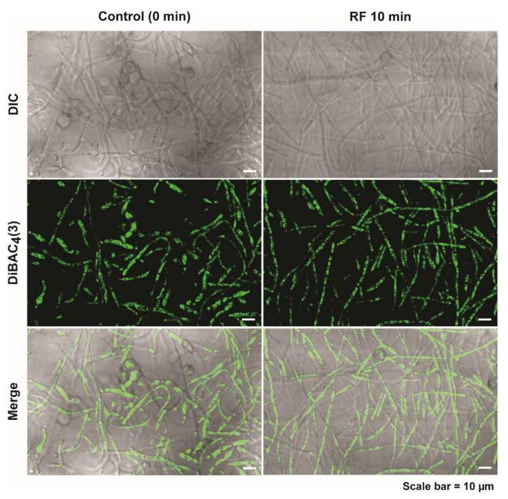https://cdn.ncbi.nlm.nih.gov/pmc/blobs/c9f0/9695996/c462ac5ed300/jof-08-01187-g006.jpg