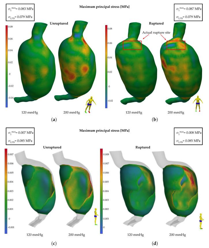 https://cdn.ncbi.nlm.nih.gov/pmc/blobs/c9f3/10886172/a494d34b4419/bioengineering-11-00144-g005.jpg