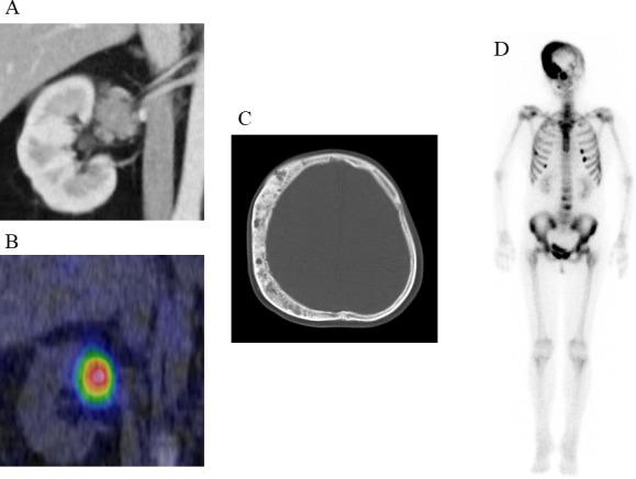 https://cdn.ncbi.nlm.nih.gov/pmc/blobs/c9f7/9373900/a948d5da161a/fendo-13-934748-g001.jpg
