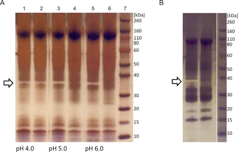 https://cdn.ncbi.nlm.nih.gov/pmc/blobs/c9f8/6597126/de528deb3460/pntd.0007431.g007.jpg