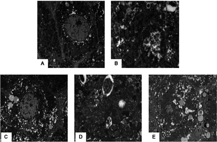 https://cdn.ncbi.nlm.nih.gov/pmc/blobs/c9fb/10980765/3238c69b5d8c/41598_2024_57852_Fig3_HTML.jpg