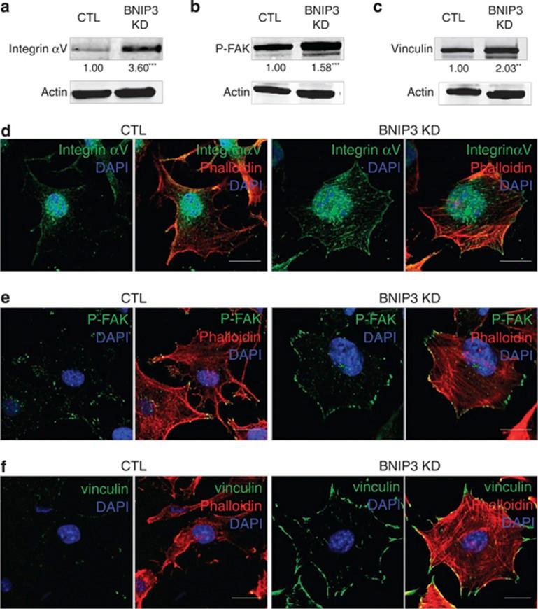 https://cdn.ncbi.nlm.nih.gov/pmc/blobs/c9fe/3973222/f7c393fdc59f/cddis201494f5.jpg
