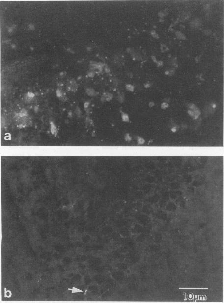 https://cdn.ncbi.nlm.nih.gov/pmc/blobs/ca03/237390/1316b0acc1ac/jvirol00022-0561-a.jpg