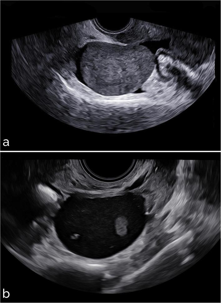 https://cdn.ncbi.nlm.nih.gov/pmc/blobs/ca09/8310829/5e80a552c76b/41747_2021_226_Fig6_HTML.jpg