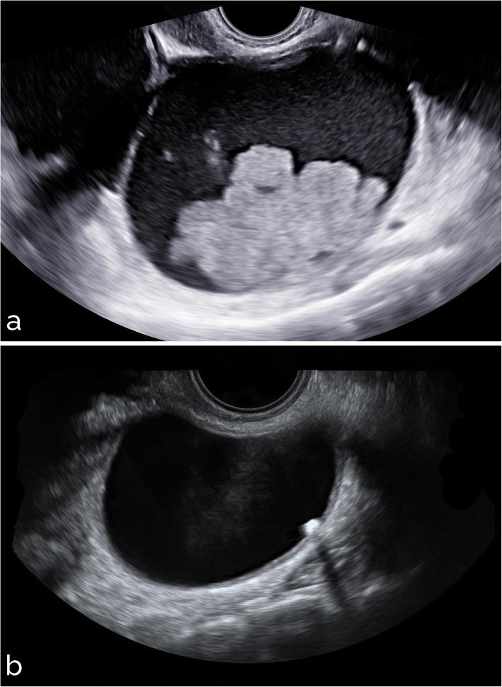 https://cdn.ncbi.nlm.nih.gov/pmc/blobs/ca09/8310829/87f3e741c78b/41747_2021_226_Fig9_HTML.jpg