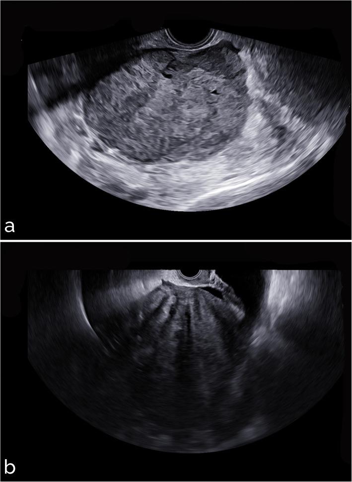 https://cdn.ncbi.nlm.nih.gov/pmc/blobs/ca09/8310829/fe27e286a76e/41747_2021_226_Fig7_HTML.jpg