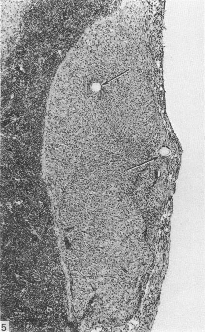 https://cdn.ncbi.nlm.nih.gov/pmc/blobs/ca0f/1168230/23266060aa42/janat00214-0024-a.jpg