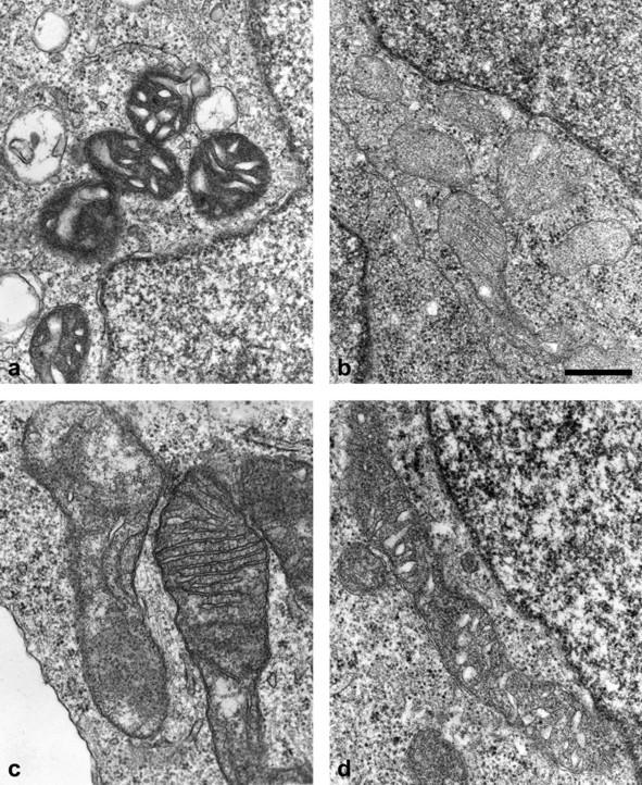 https://cdn.ncbi.nlm.nih.gov/pmc/blobs/ca0f/517501/b63feb2a69de/1471-2407-4-55-3.jpg