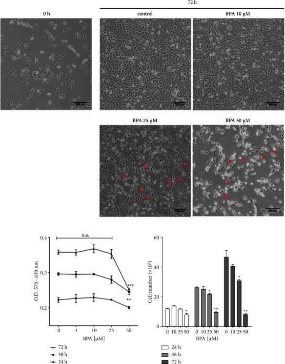 https://cdn.ncbi.nlm.nih.gov/pmc/blobs/ca1a/10917485/43b9e9fa8312/JT2024-3840950.001.jpg