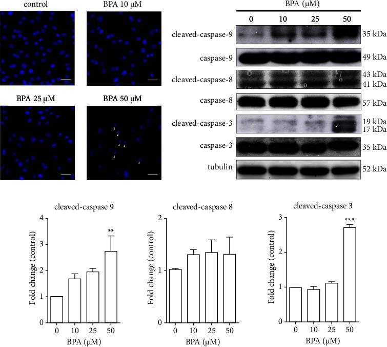 https://cdn.ncbi.nlm.nih.gov/pmc/blobs/ca1a/10917485/c6eb7db9fca3/JT2024-3840950.003.jpg
