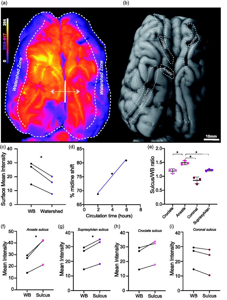 https://cdn.ncbi.nlm.nih.gov/pmc/blobs/ca1a/8393296/80b9aac48920/10.1177_0271678X21996175-fig1.jpg