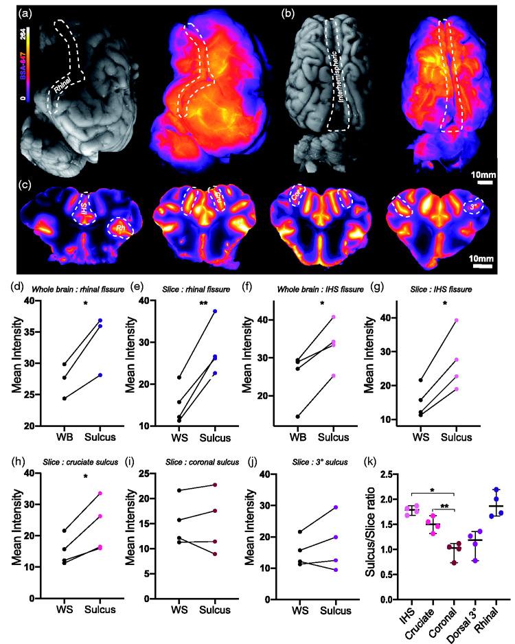 https://cdn.ncbi.nlm.nih.gov/pmc/blobs/ca1a/8393296/fc28107f2626/10.1177_0271678X21996175-fig2.jpg