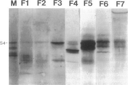 https://cdn.ncbi.nlm.nih.gov/pmc/blobs/ca1b/205015/4b1146c7fbeb/jbacter00019-0098-b.jpg