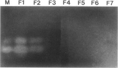 https://cdn.ncbi.nlm.nih.gov/pmc/blobs/ca1b/205015/f9edf3d42414/jbacter00019-0098-a.jpg