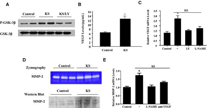 https://cdn.ncbi.nlm.nih.gov/pmc/blobs/ca21/4323828/80dd7d7fc8b1/jah3-3-e001194-g7.jpg