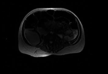 https://cdn.ncbi.nlm.nih.gov/pmc/blobs/ca2b/7704175/303c41fedbf4/CRIOG2020-8894722.001.jpg